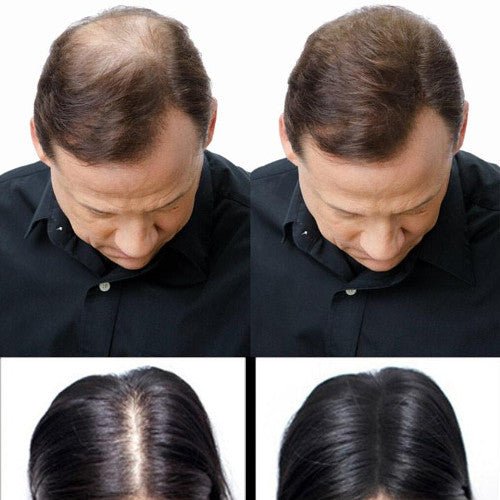 Infultus Fibre per Capelli in Cheratina – Volume Istantaneo Naturale - Bioniva