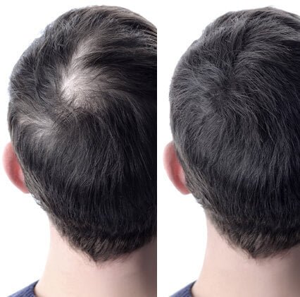 Hairtivator Spray Anticaduta – Stimola la Ricrescita dei Capelli - Bioniva